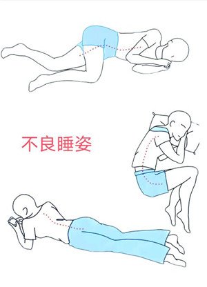 睡姿對(duì)脊柱側(cè)彎患者的影響