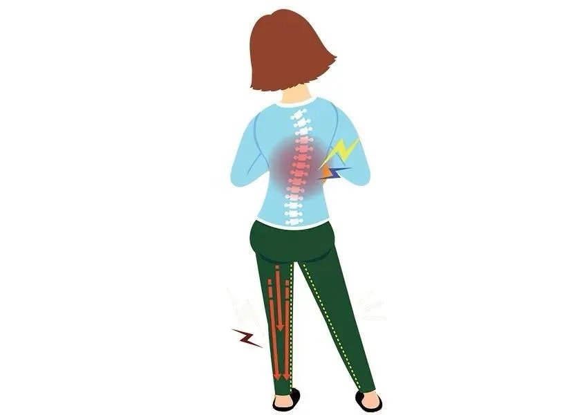 關(guān)注脊柱健康